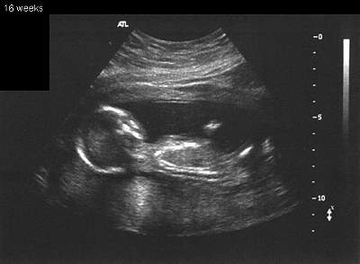Pregnancy Ultrasound Picture : week 16