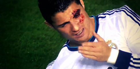 Cristiano Ronaldo cleaning his face full of blood, after being hit with an elbow and making a big cut on his eye, in Levante vs Real Madrid in 2012