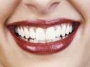 پودر سفید کننده دندان , وی وان دندان , پودر سفید کننده دندان وی وان 