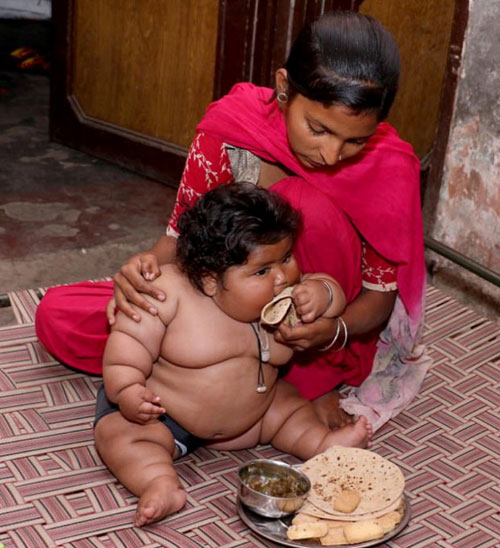اخبار,اخبار گوناگون,شیرخوار هندی با چاقی بیش از حد