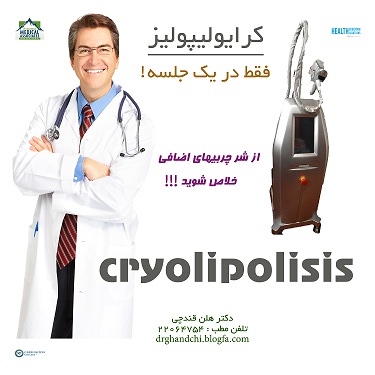 آیا می دانید کرایولیپولیز  (cryolipolisis) چیست؟