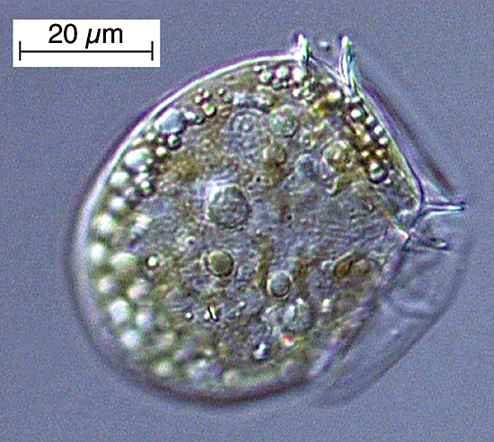 داینوفلاژله ها( dinoflagellates)