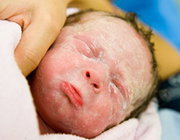 ورم نوزاد تازه متولد شده 