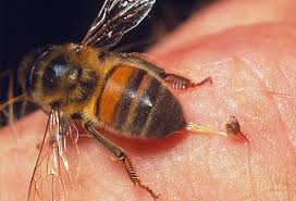 درمان نیش زنبور زرد , نیش زنبور و التهاب ریه , مرحم برای نیش زنبورعسل 