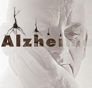 دارو درمانی آلزایمر