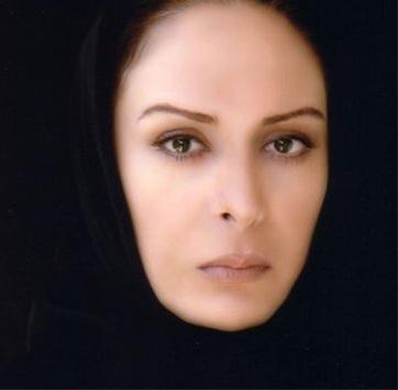 عکس بازیگران زن ایرانی بعد از جراحی بینی