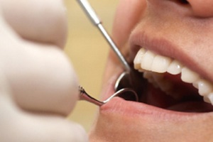 ترمیم دندان , بهترین روش ترمیم رنگ دندان جلو , انواع ترمیم دندان 
