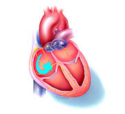 heart-13.jpg